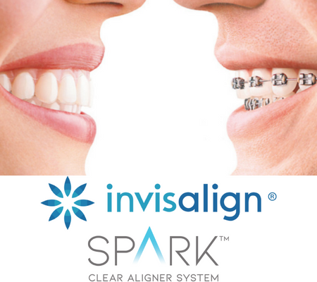 Orthodontics - Invisalign