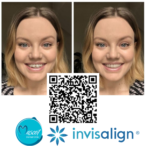 Invisalign - Smileview